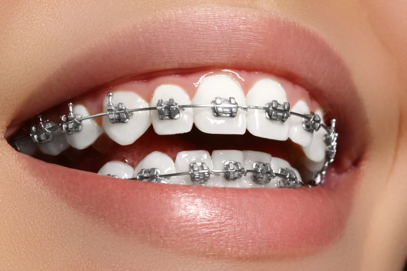 shutterstock 417290032 scaled
