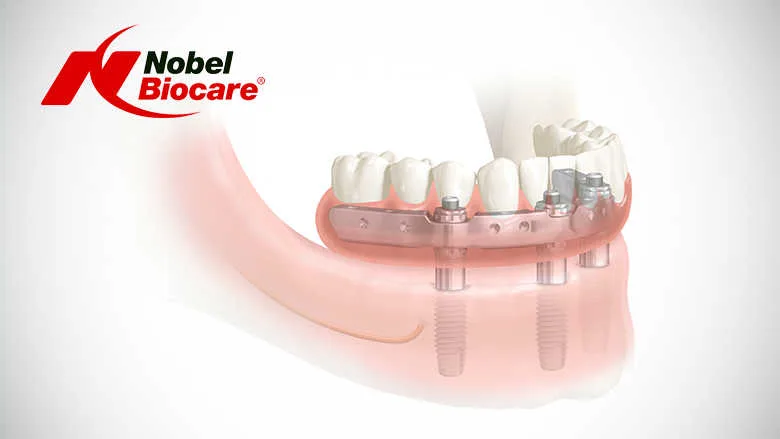 Nobel IDEM 780x439 