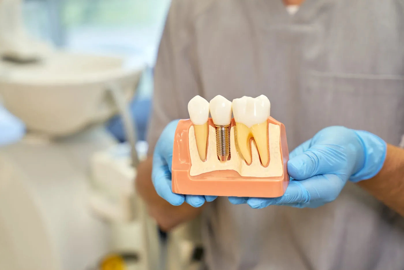 Implant dentar respins de organism? Iată care sunt simptomele!