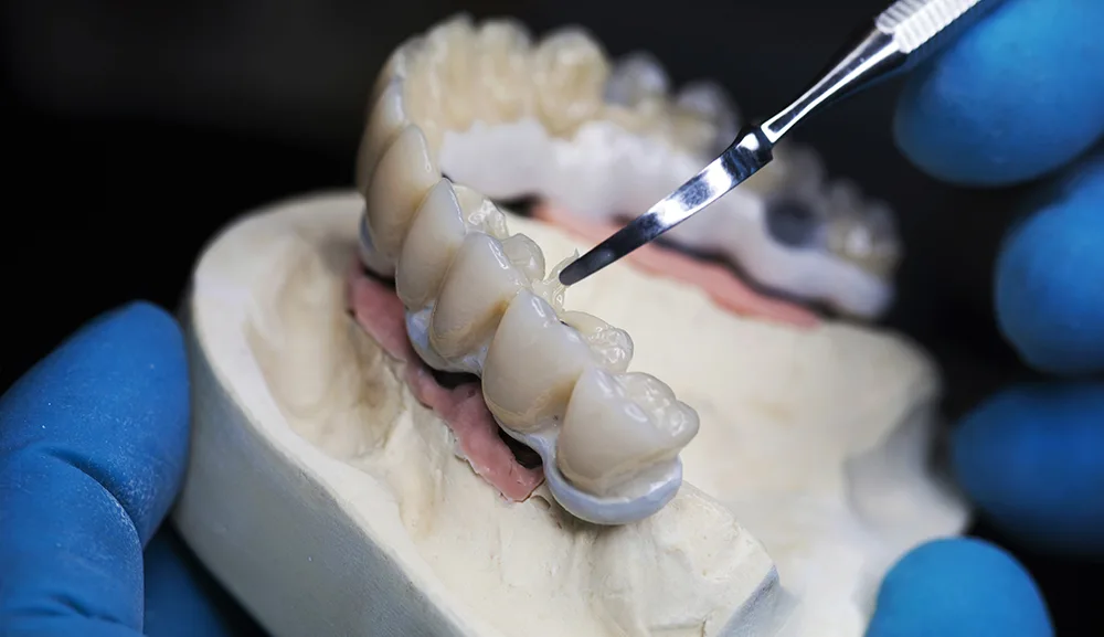 Tehnician dentar care finisează o proteză dentară în laborator, Dentetico Brașov