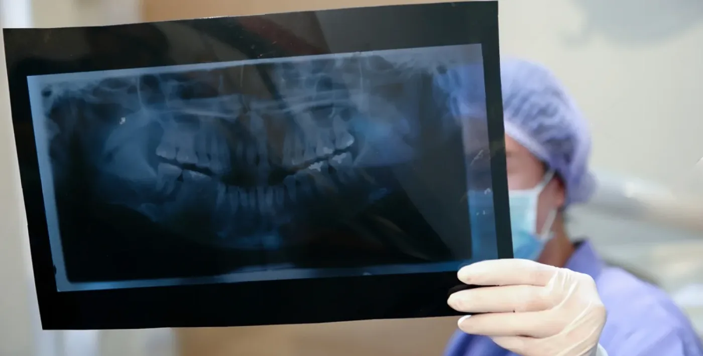 radiologie dentară crop