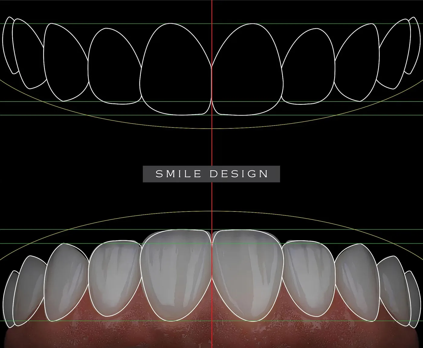 Etapele planificării Digital Smile Design la Dentetico