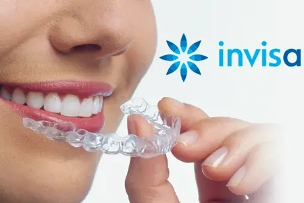 Aparat dentar invizibil Invisalign la clinica Dentetico Brașov